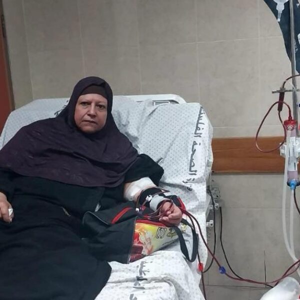 Woman receiving dialysis.