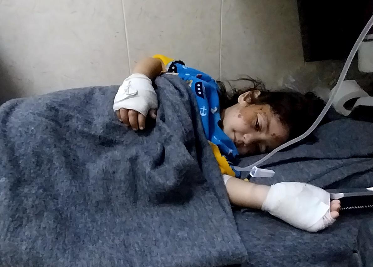 Injured girl with bandaged hands lying on blanket.