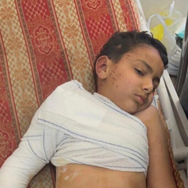 Injured boy with bandaged shoulder and arm.